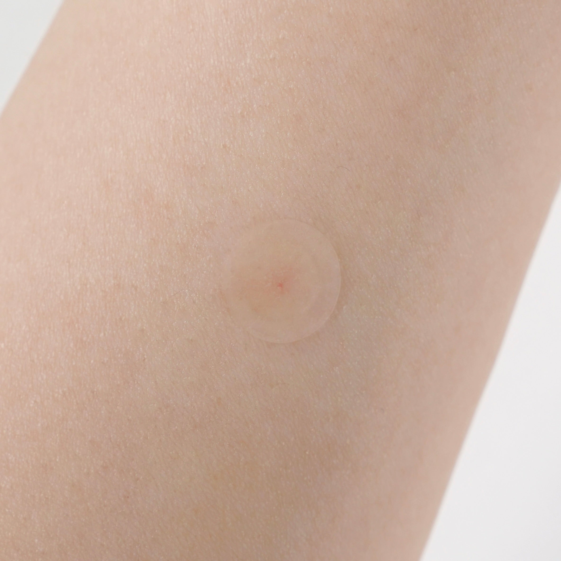 Clear Skin Shield Patch